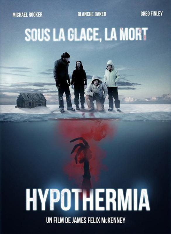Hypothermia online